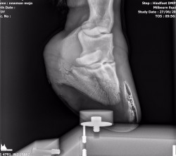 X-rays of hoof before resection from vet
